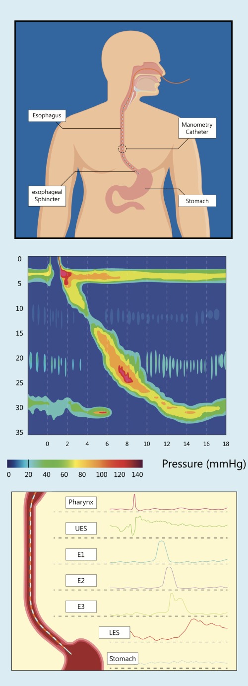 Oesophageal manometry